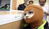 توصیه‌های اورژانسی چهارشنبه‌ آخر سال / روی سوختگی خمیردندان، خیار یا سیب‌زمینی نگذارید